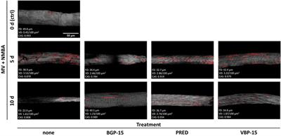 Single fibre cytoarchitecture in ventilator-induced diaphragm dysfunction (VIDD) assessed by quantitative morphometry second harmonic generation imaging: Positive effects of BGP-15 chaperone co-inducer and VBP-15 dissociative corticosteroid treatment